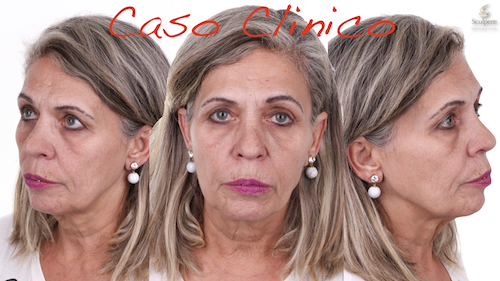 imagem do caso clínico