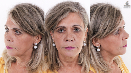 imagem do caso clínico