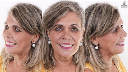 imagem do caso clínico