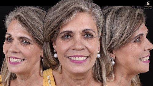 imagem do caso clínico